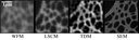 Comparaison entre différentes techniques de microscopie